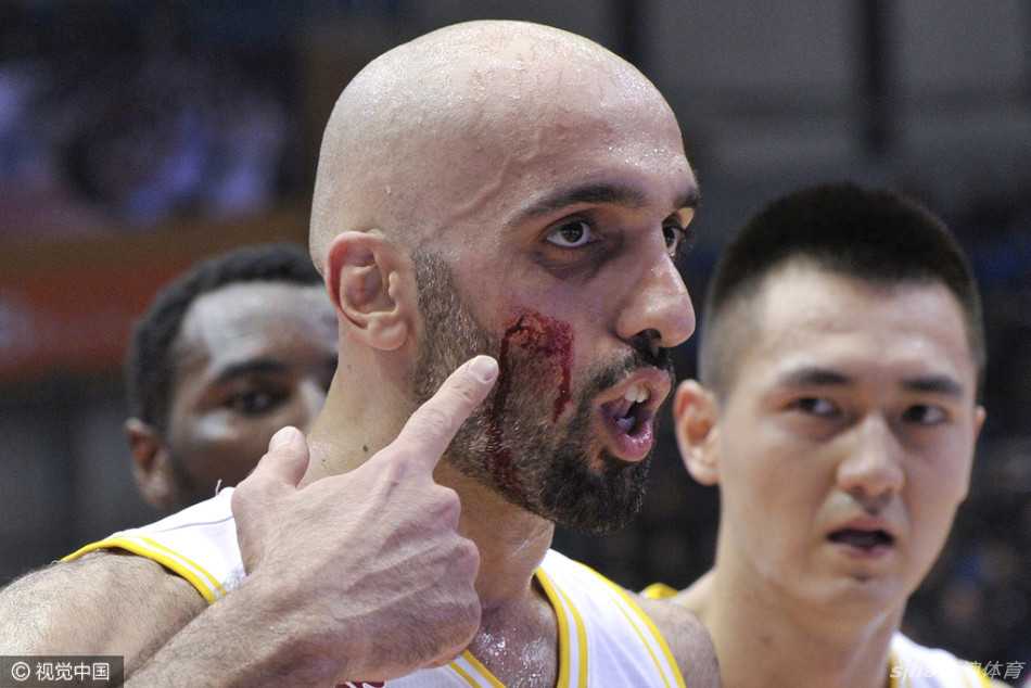 阿巴斯被张松涛肘击瞬间，身体失衡倒地，表情痛苦，场上气氛骤然紧张。