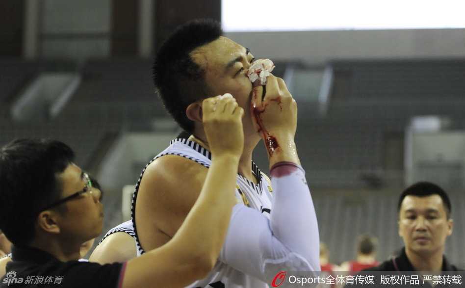 激烈的篮下卡位战中，韩德君如同一座铁塔般奋力跃起，却在与对方防守球员的猛烈碰撞中，面部瞬间被击中，鲜血立刻染红了他的衣襟，场面令人揪心不已。