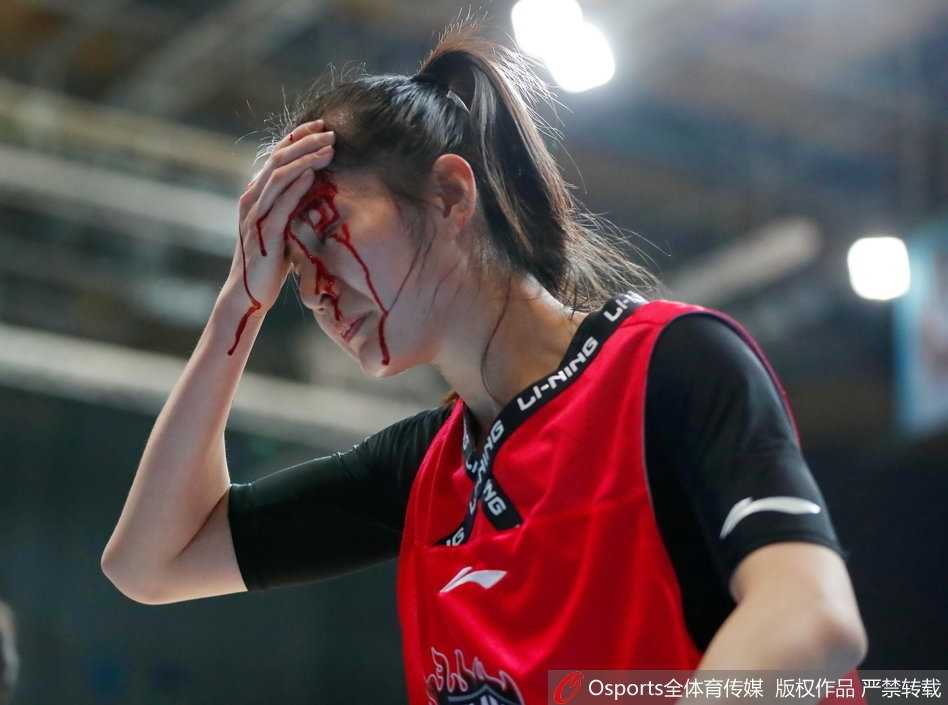 受伤后的郭子瑄无法继续比赛，坐在替补席上关注着场上的战况，眼神中满是焦急与关切，心系球队胜负。